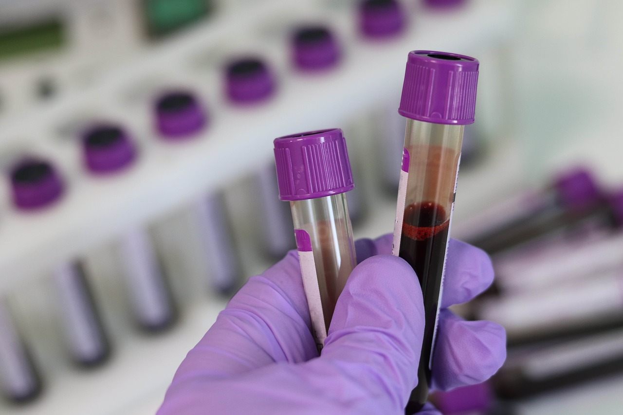 sample blood vials ready for lab testing